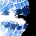 Xray of mouth